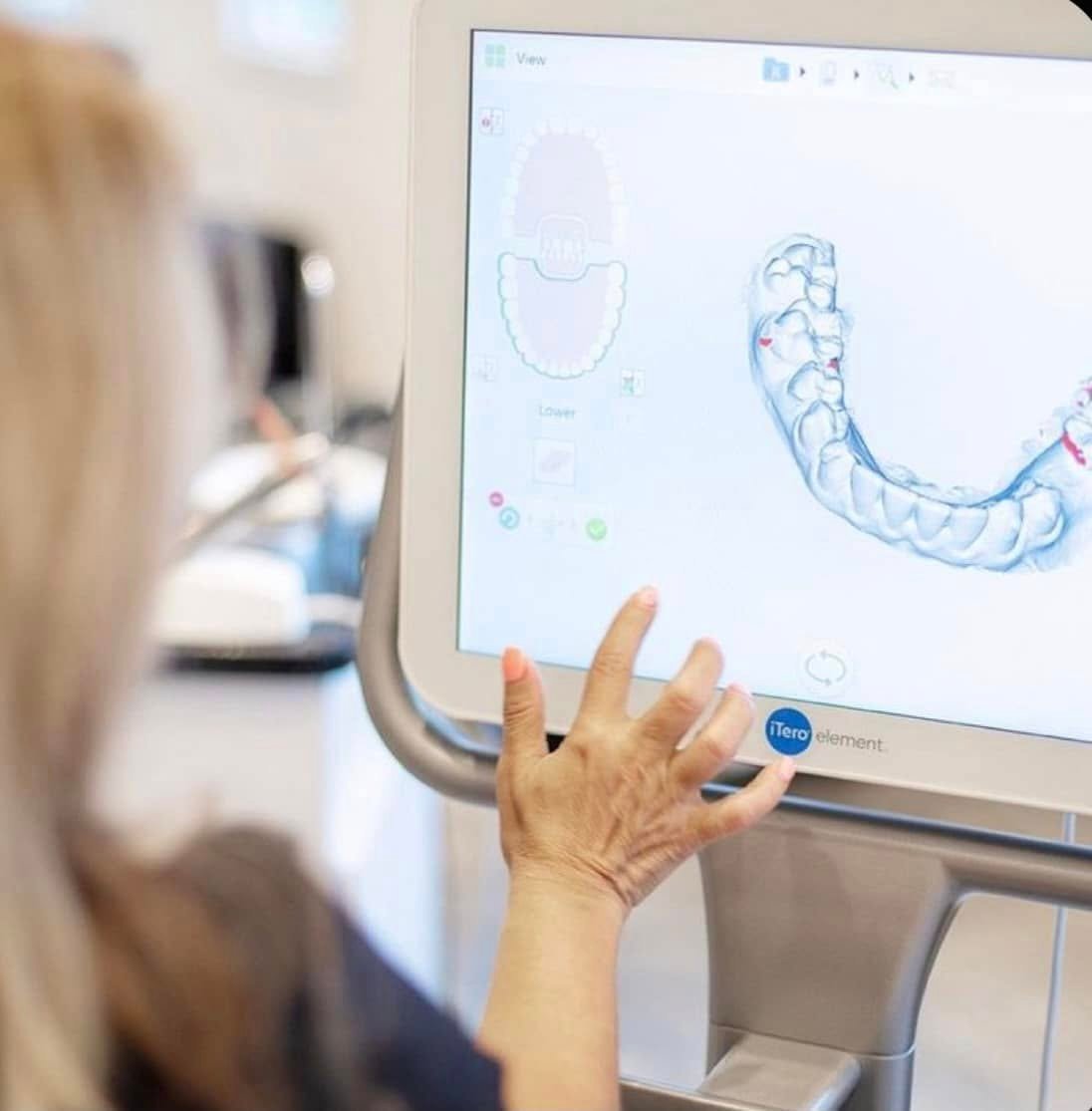 In-office digital scanner for same-day crowns and 3D imaging