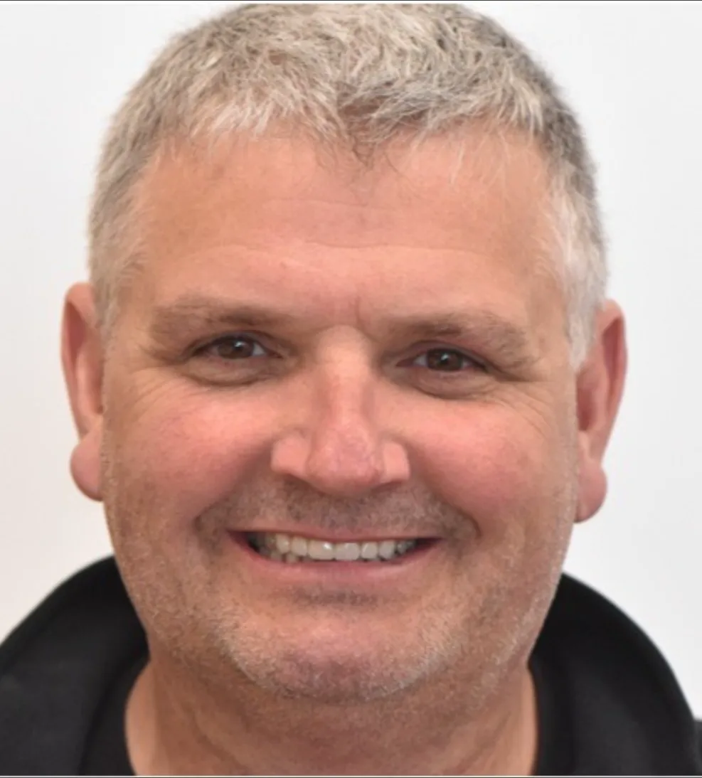 After: full restored smile after treatment at Redwater Dental Clinic